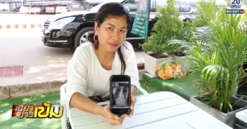 กระดูกสันหลังคด