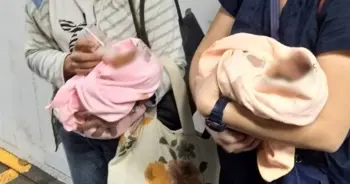 ทารกแฝด