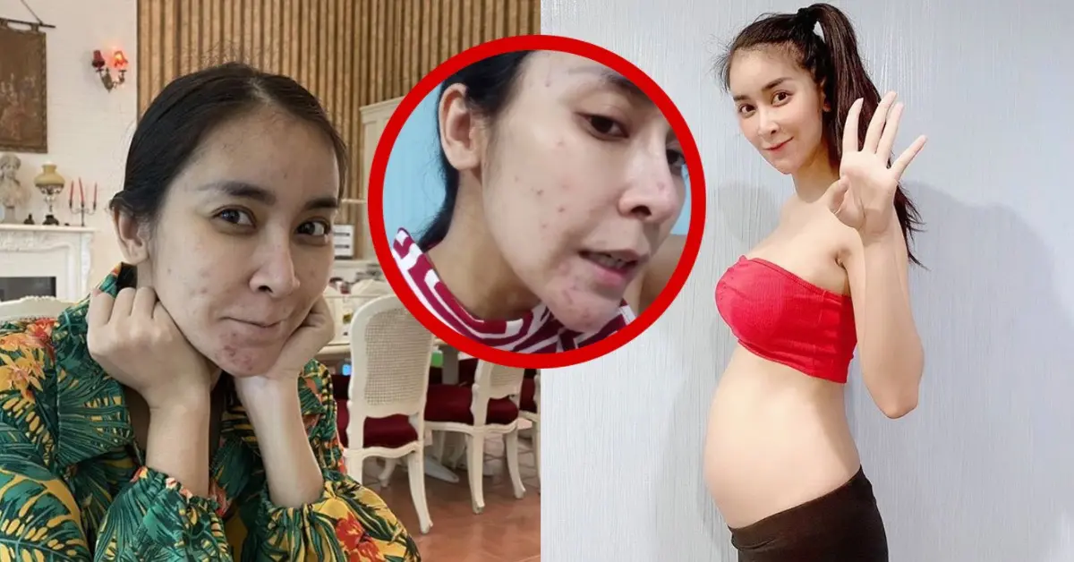 ใหม่ สุคนธวา