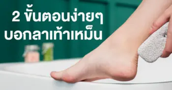 แก้เท้าเหม็น