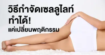 วิธีกำจัดเซลลูไลท์