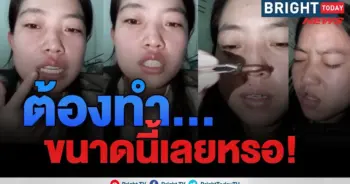 ผึ้งต่อย