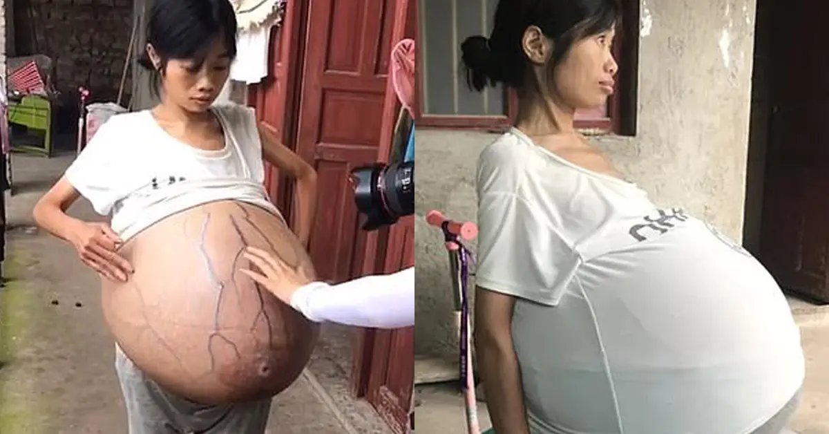 สววจีนป่วยปริศนา