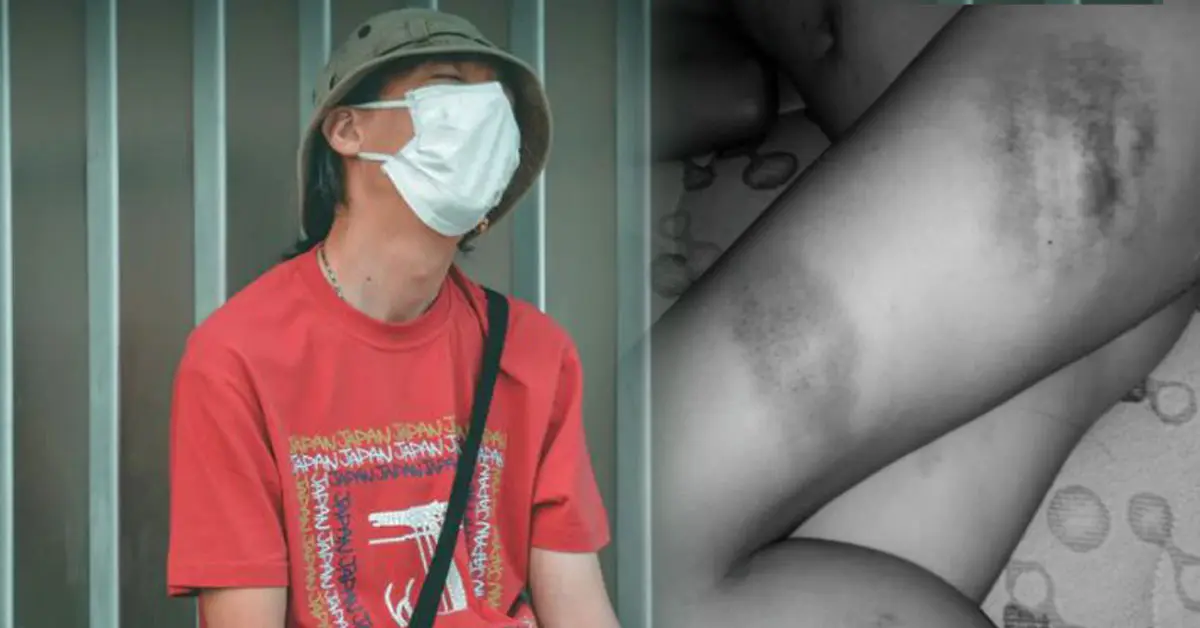 เมียโดนรุมโทรม ป่วยจิต