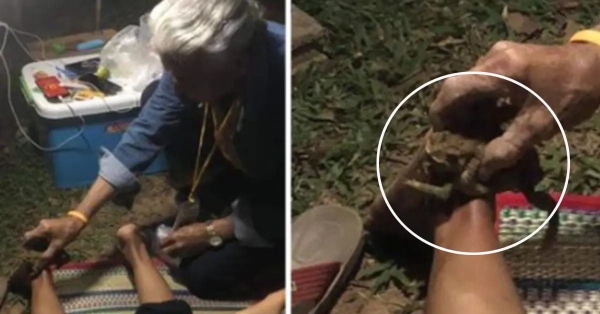 คางคกดูดพิษตะขาบ