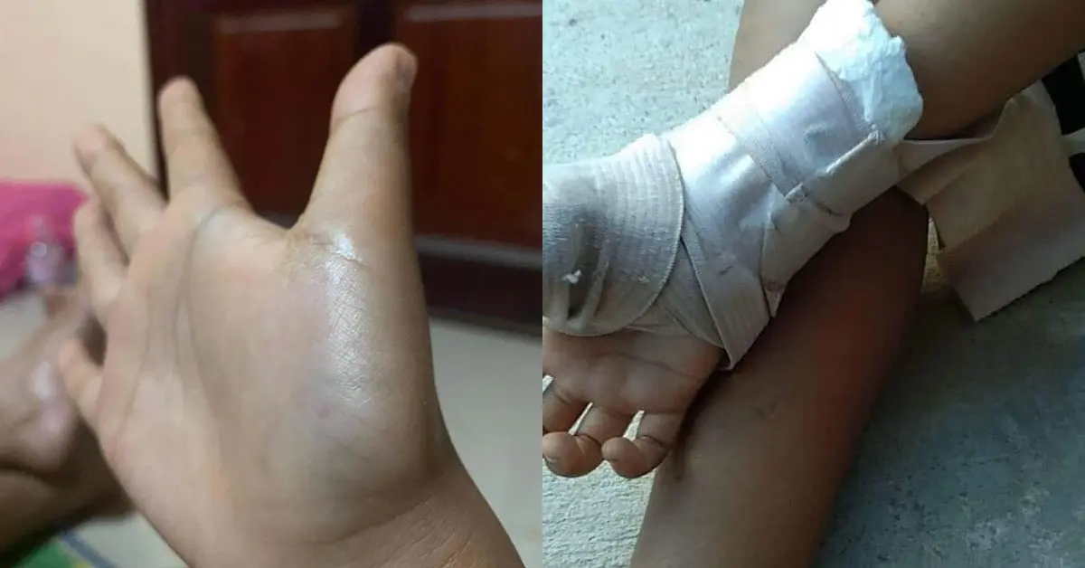 ครูตีนักเรียนเอ็นขาด