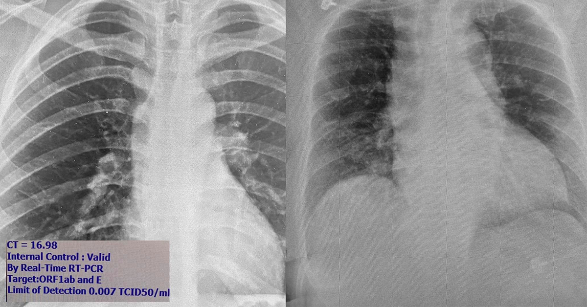 โควิด-19 ปก