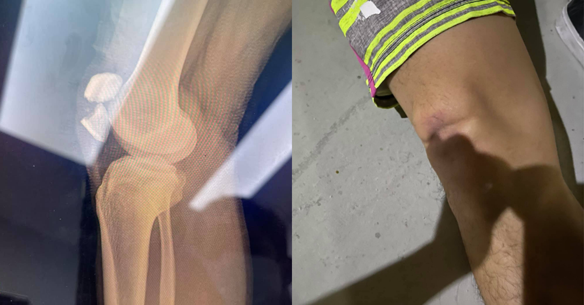 สเก็ต ปก