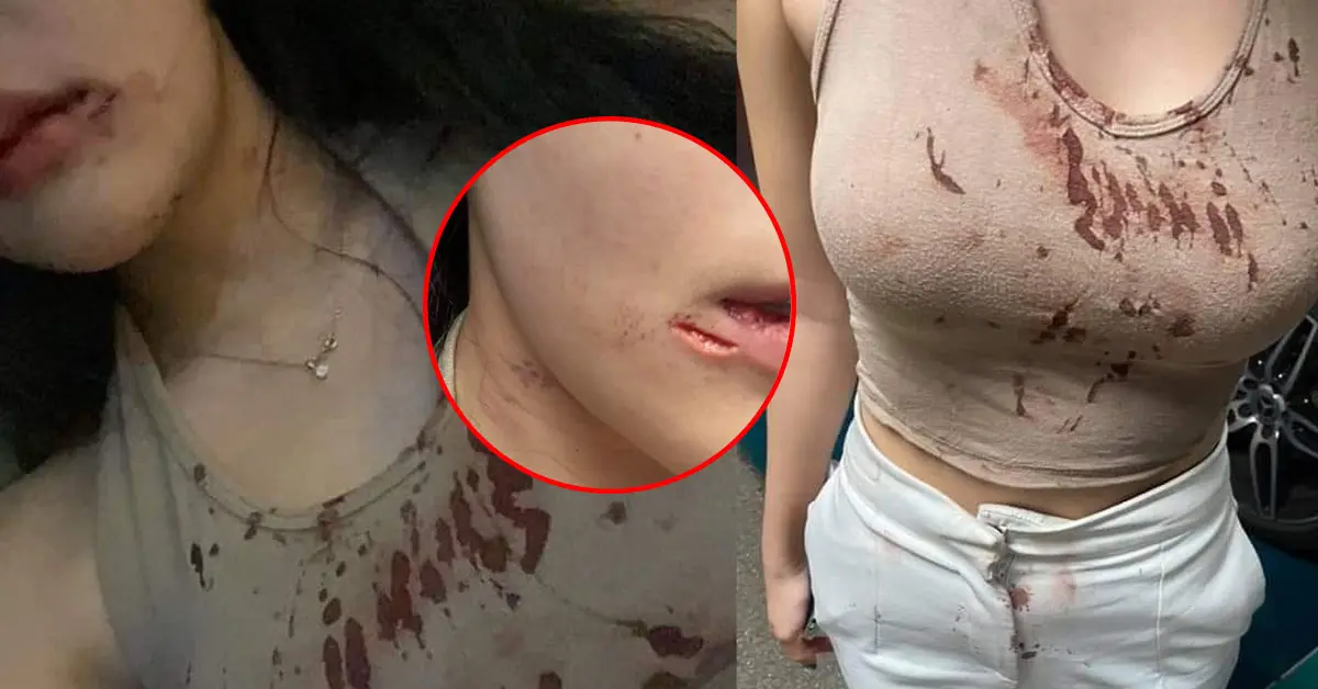 พริตตี้สาวถูกซ้อม