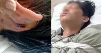 บุรุษพยาบาลทำร้ายคนไข้