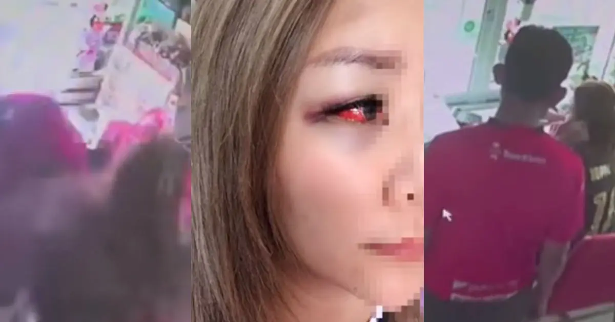 พ่อกระทืบลูกสาว ปางตาย