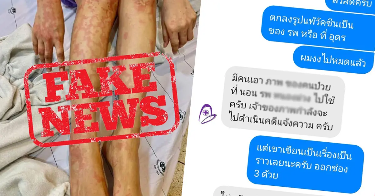 เฟคนิวส์ ผื่น วัคซีนโควิด