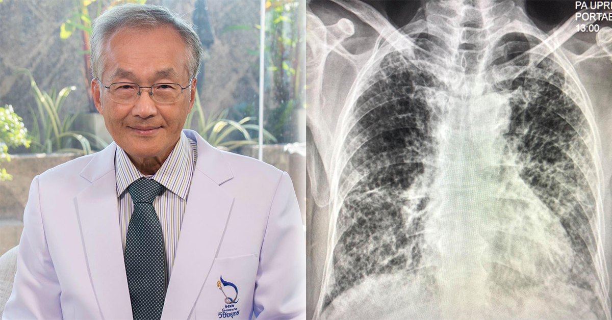 เล่นงานปอดรุนแรงกว่าเชื้อสายพันธุ์เดิมในรอบก่อน ปก