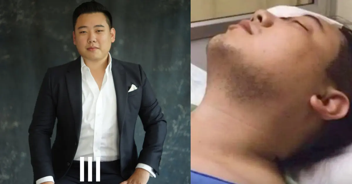 ไฮโซลูกนัท