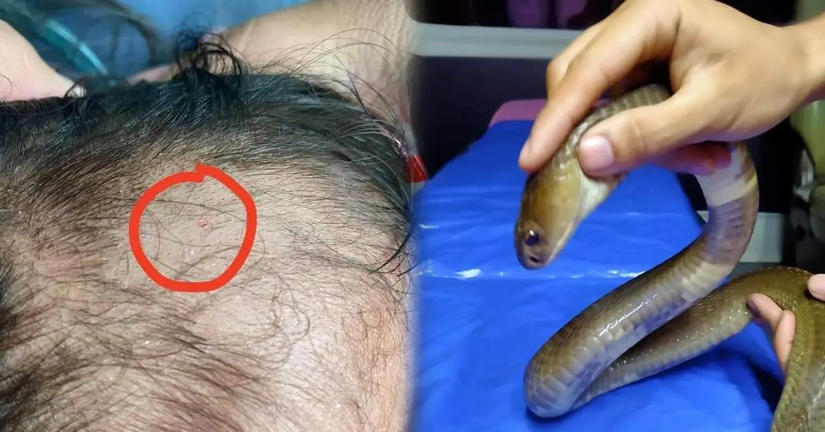 งูฉกหัว ปก