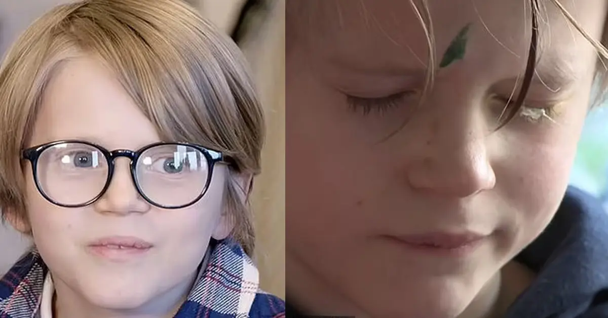 กาวหยอดตาลูก