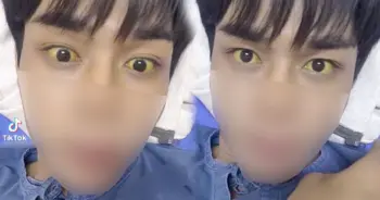 ฉีดวัคซีน