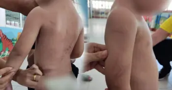 เด็กน้อยถูกพี่เลี้ยงทำร้าย