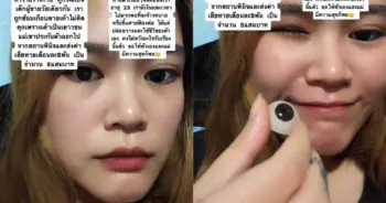 เสียดวงตา