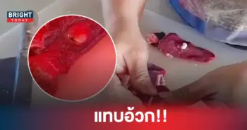 หนองในตับเหล็กหมู