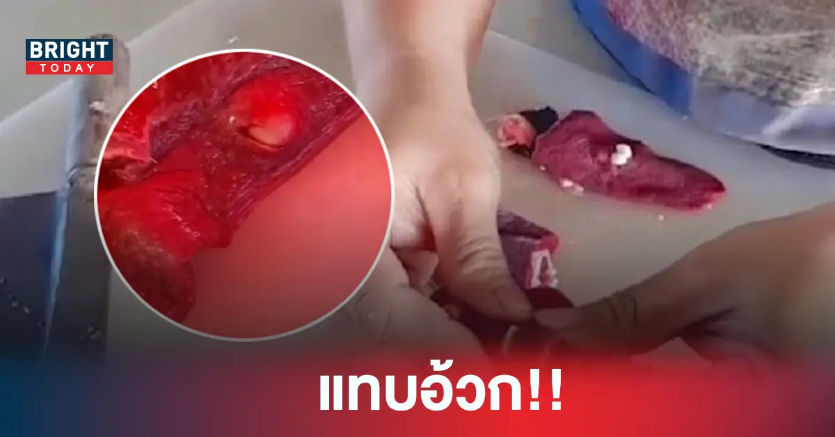 หนองในตับเหล็กหมู