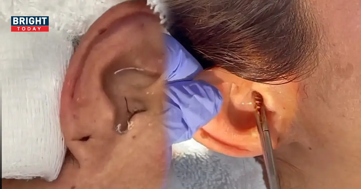 แมลงเข้าหู