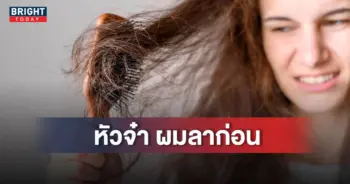 ปกผมร่วงผมบาง