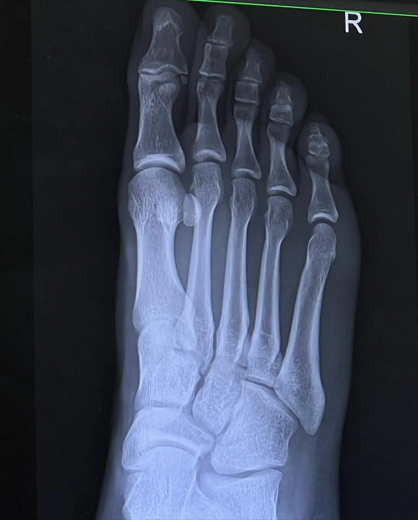 ดีเจบอส-5