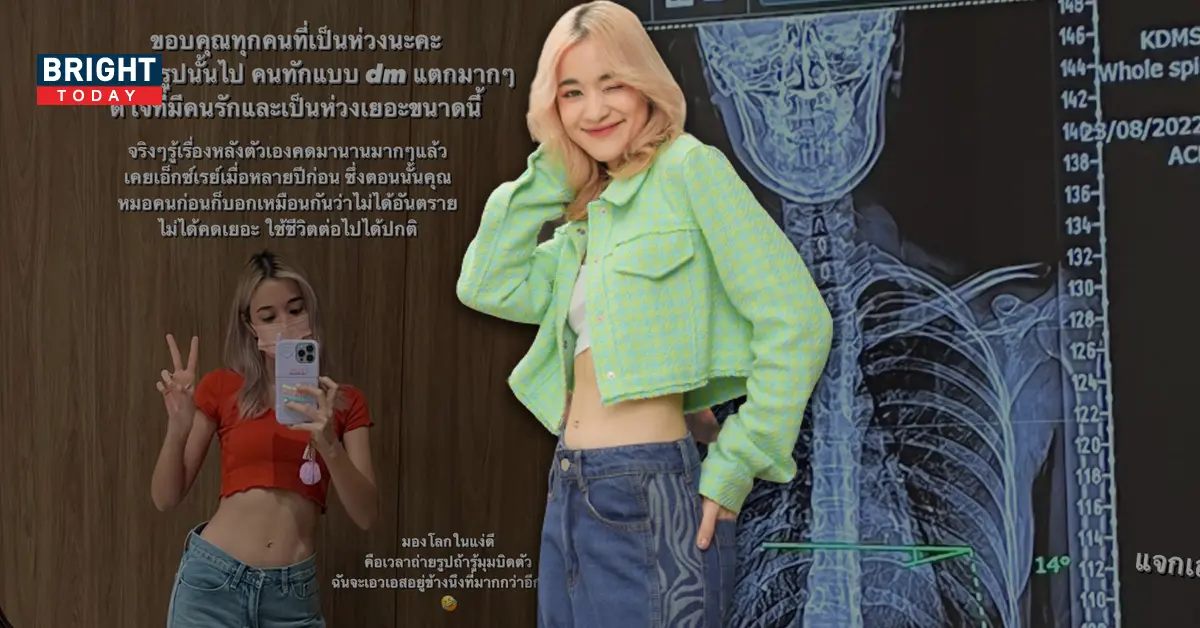 ส้ม-มารี-กระดูกสันหลัง-เว็บ