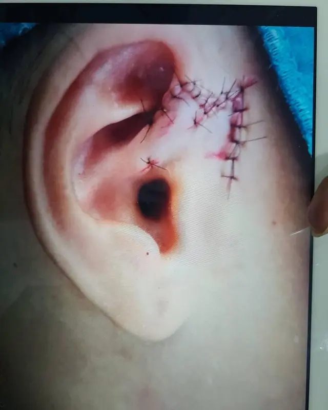 -อุบัติเหตุ-7