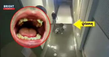 ถูกดีเจชื่อดังกระทืบ ฟันหน้าหัก