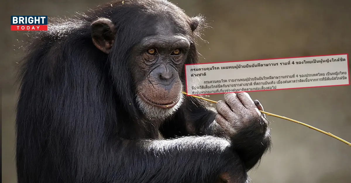 ฝีดาษลิง ราย4