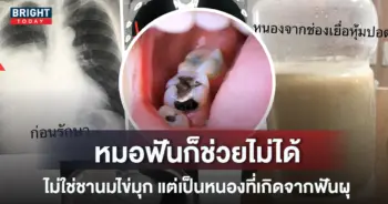 หนอง