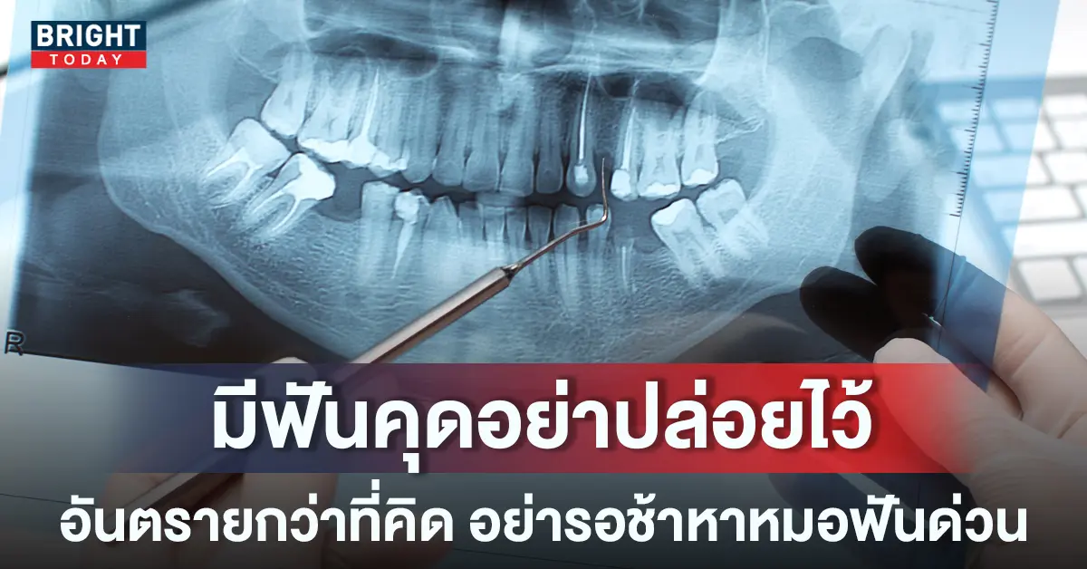 ฟันคุดหน้าปกใหม่