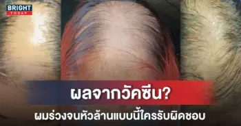 ผมร่วง