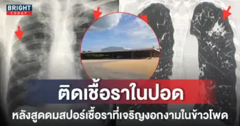 -เชื้อราจากเมล็ดข้าวโพดลงปอด
