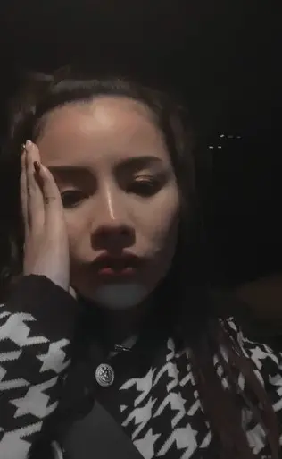 นักร้องสาว-ช็อกกลางเวที-มือกีตาร์เมากร่าง-ทำร้าย-ผจก.-ได้รับบาดเจ็บ-7