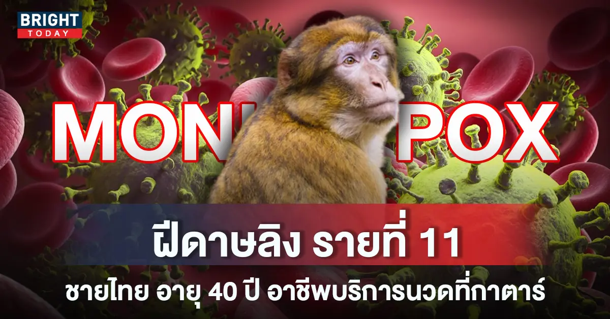 4ฝีดาษ