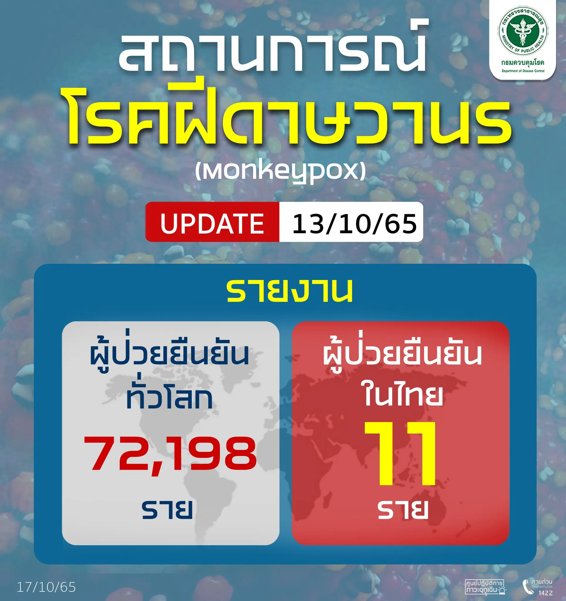 รายงานฝีดาษลิง