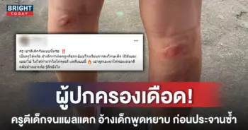 หน้าปกใหม่-เด็กโดนครูตีแผลแตก