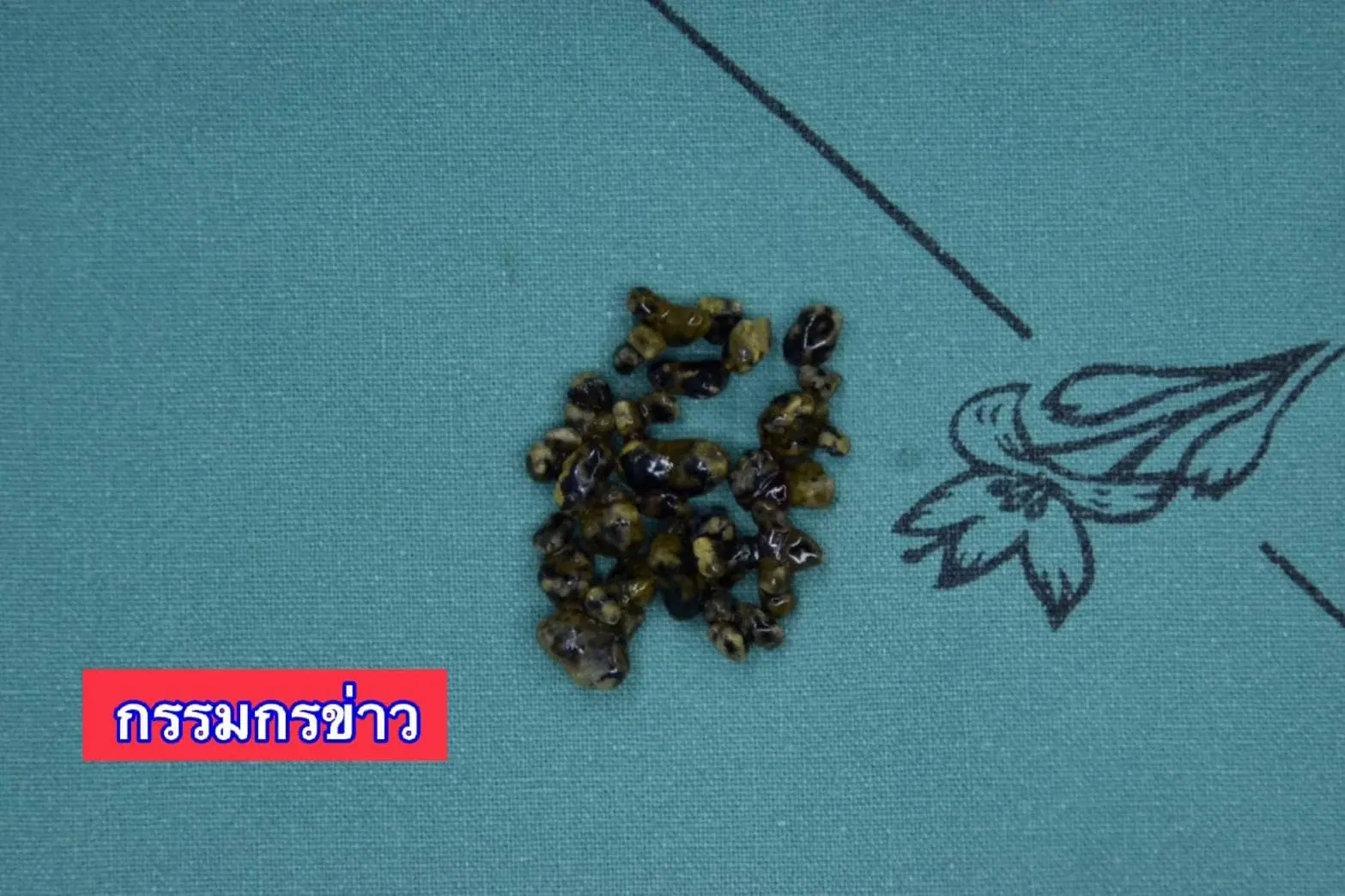 นิ่ว