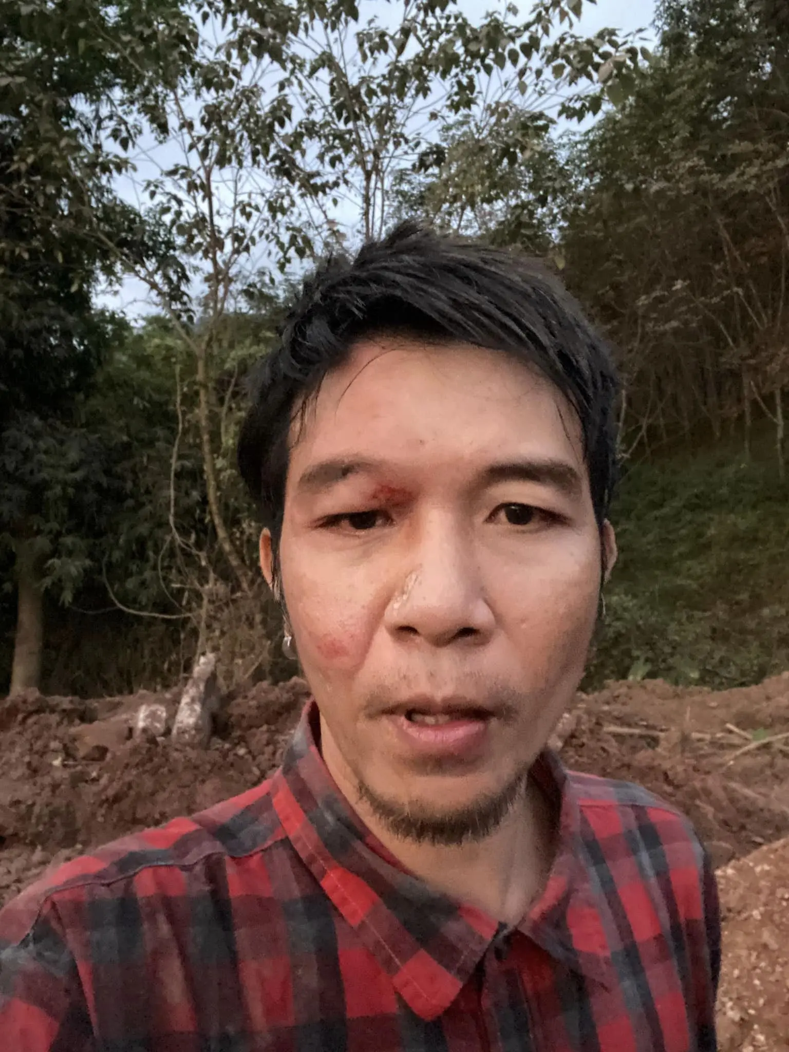 ตกบ่อข้างทาง-4