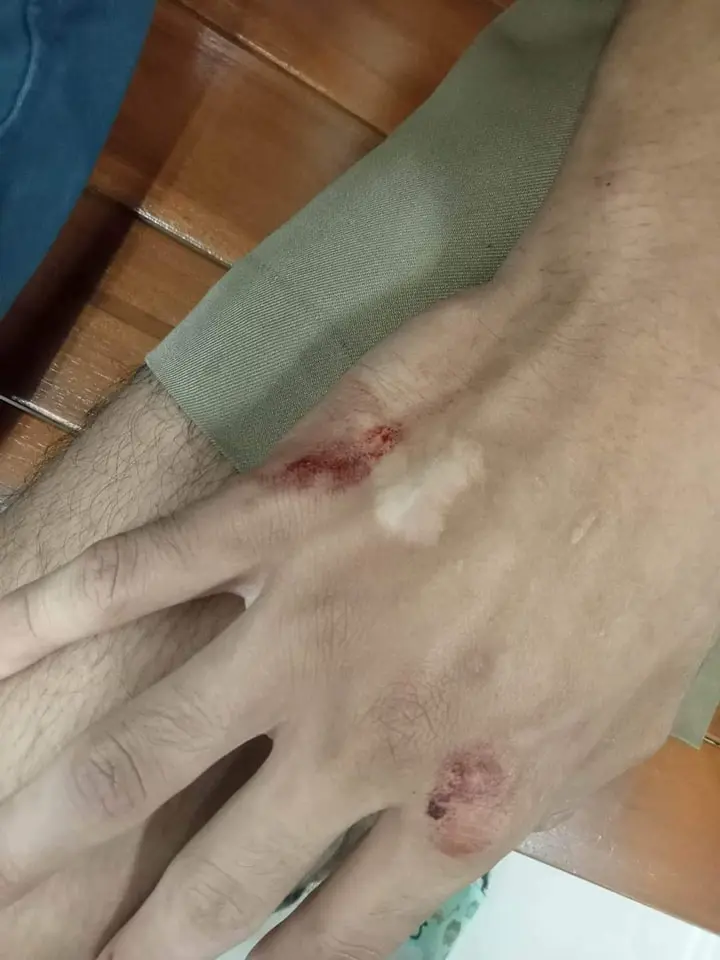 ตีผิดตัว-3