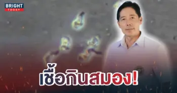 อะมีบากินสมอง