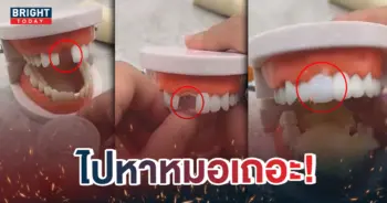 หน้าปกใหม่-ฟันปลอม