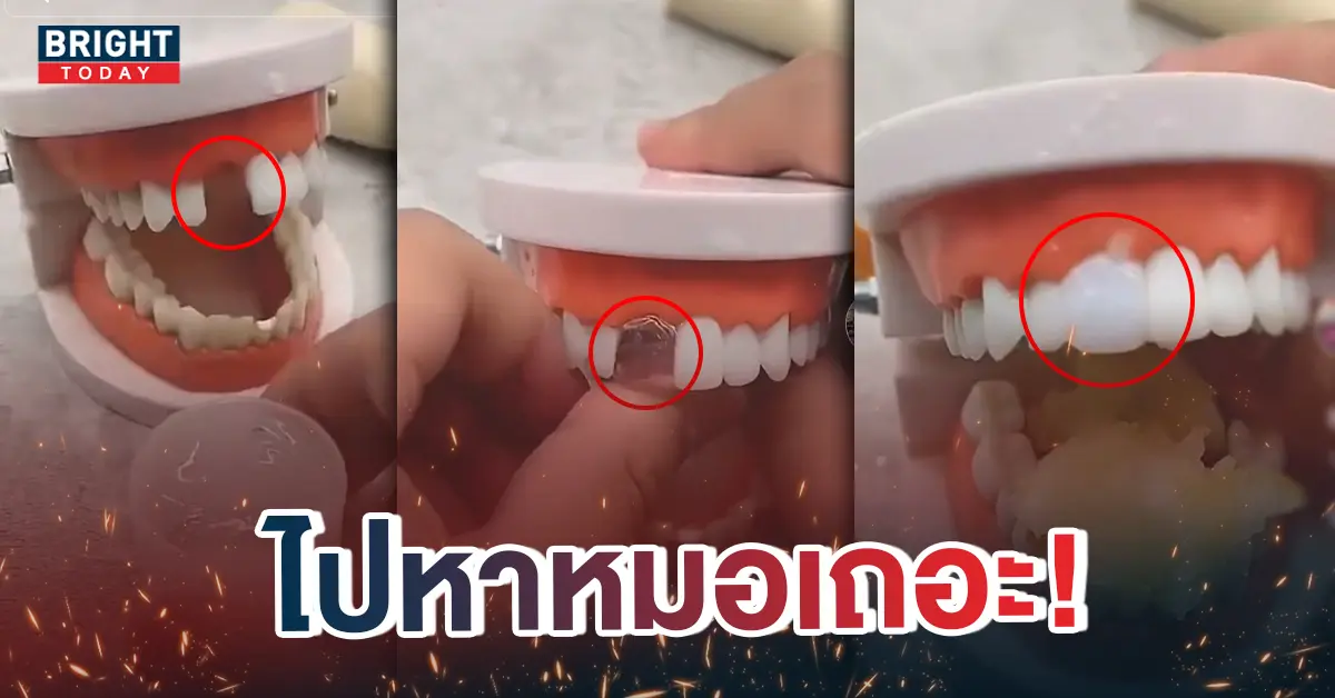 หน้าปกใหม่-ฟันปลอม