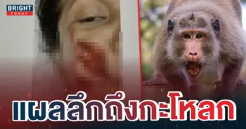 ลิงป่ากัด