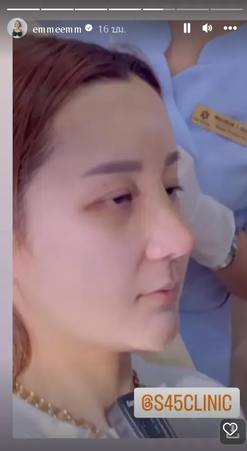 สุดดีใจ-เอ็ม-บุษราคัม-เผยจมูกใหม่สุดปัง-พุ้งสวยมาก-หลังถอดเฝือก-3