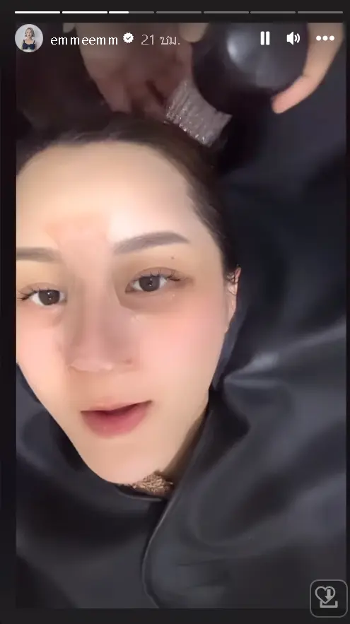 สุดดีใจ-เอ็ม-บุษราคัม-เผยจมูกใหม่สุดปัง-พุ้งสวยมาก-หลังถอดเฝือก-2
