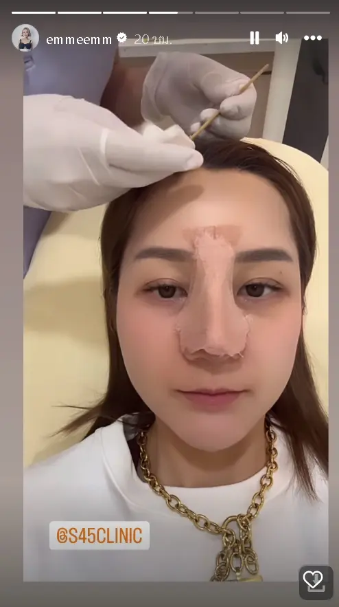 สุดดีใจ-เอ็ม-บุษราคัม-เผยจมูกใหม่สุดปัง-พุ้งสวยมาก-หลังถอดเฝือก-1